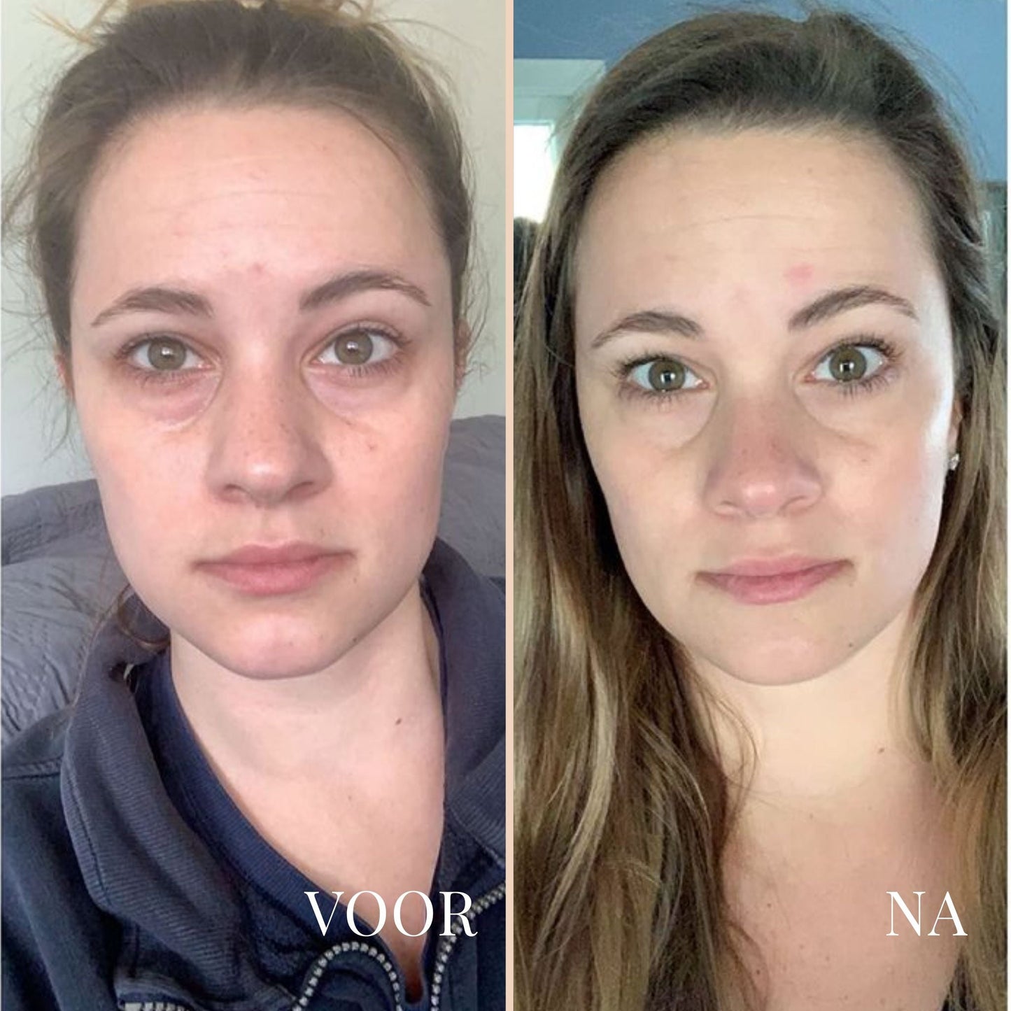 LinaLift | Huidverzorging Nek en Oog Versterker Crème 8