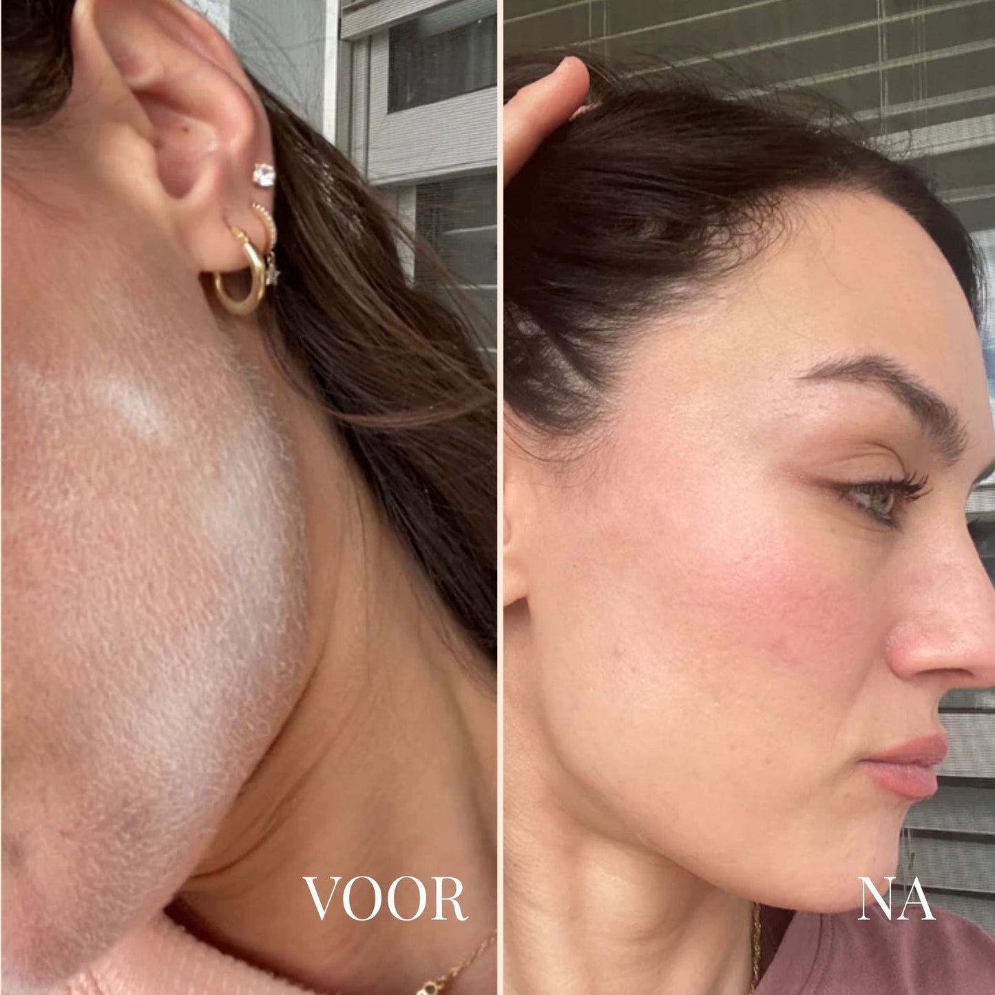 PeachAway | Gezichtshaarscheerder voor een Stralende Huid 6