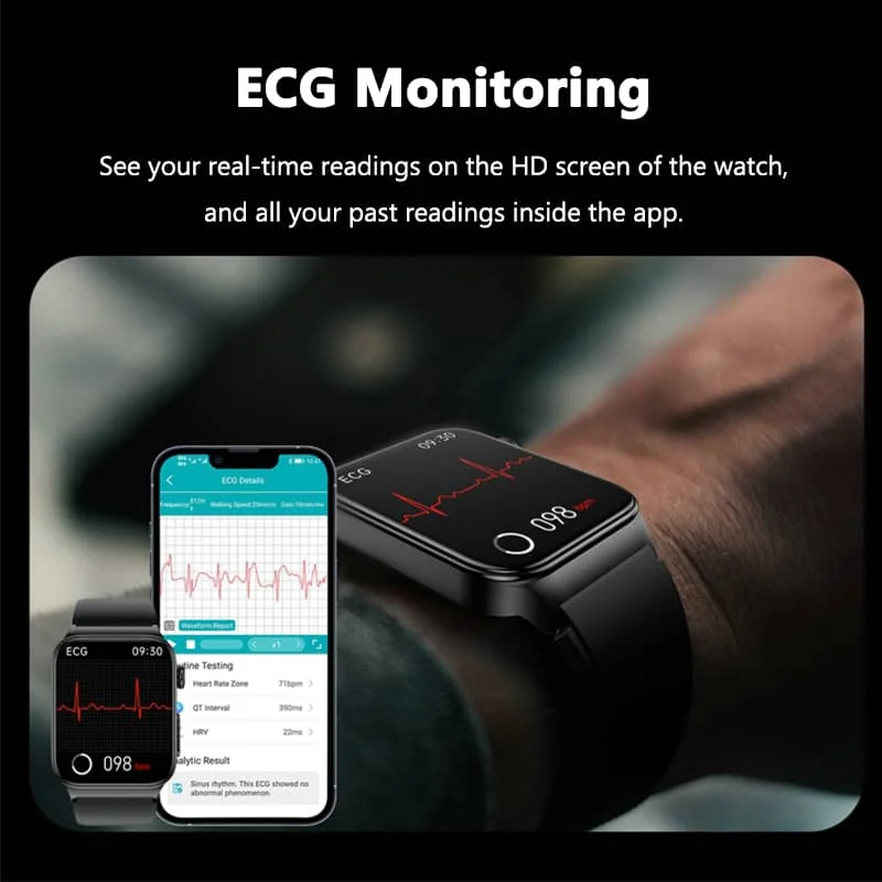ECG Smartwatch | Multifunctionele Gezondheidsmonitor 2