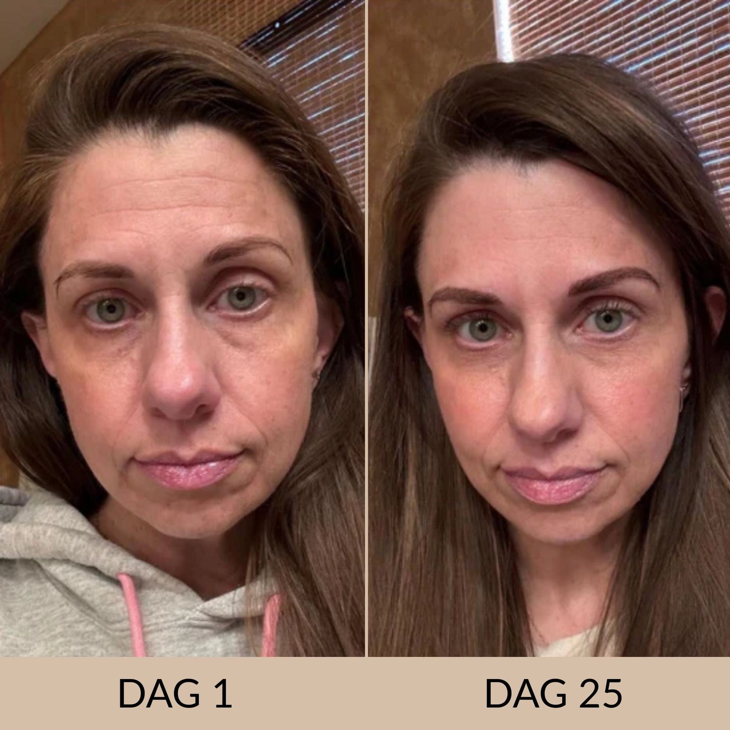 GlowSculpt | Gezichtsmasker voor Stralende Huid 4