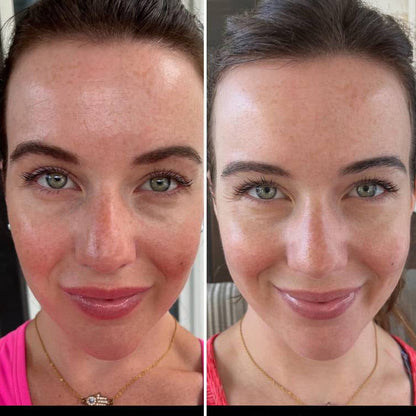 LED Gezichtsmasker | Collageen Lichttherapie Apparaat 3