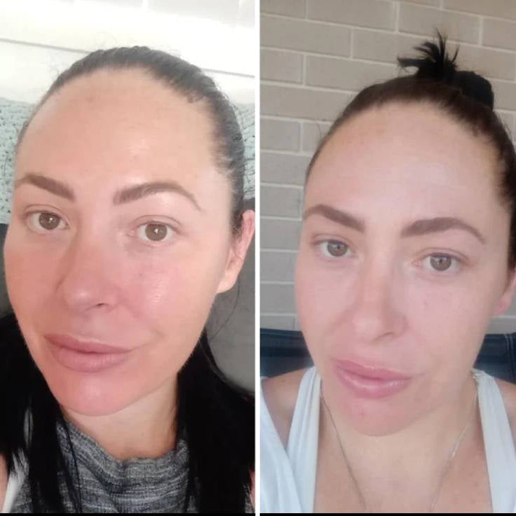 LED Gezichtsmasker | Collageen Lichttherapie Apparaat 4