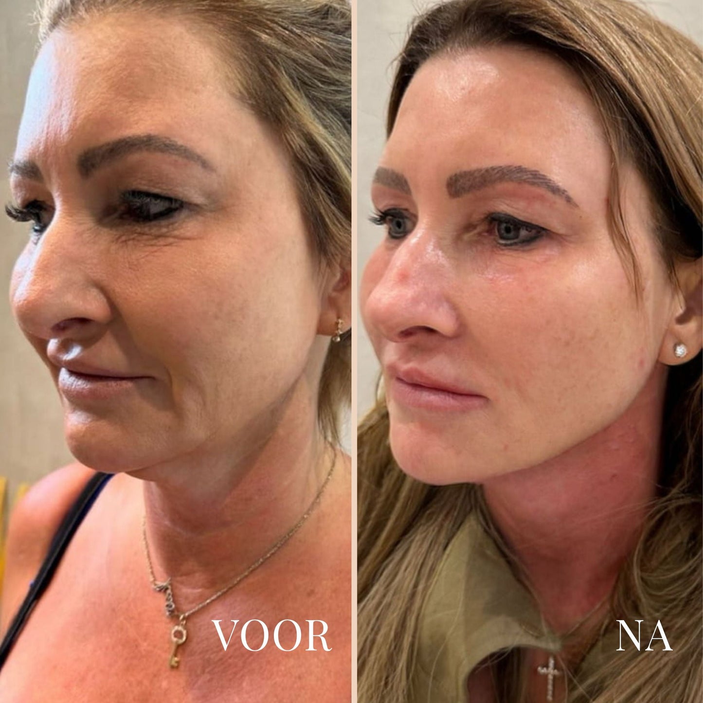 LinaLift | Huidverzorging Nek en Oog Versterker Crème 5