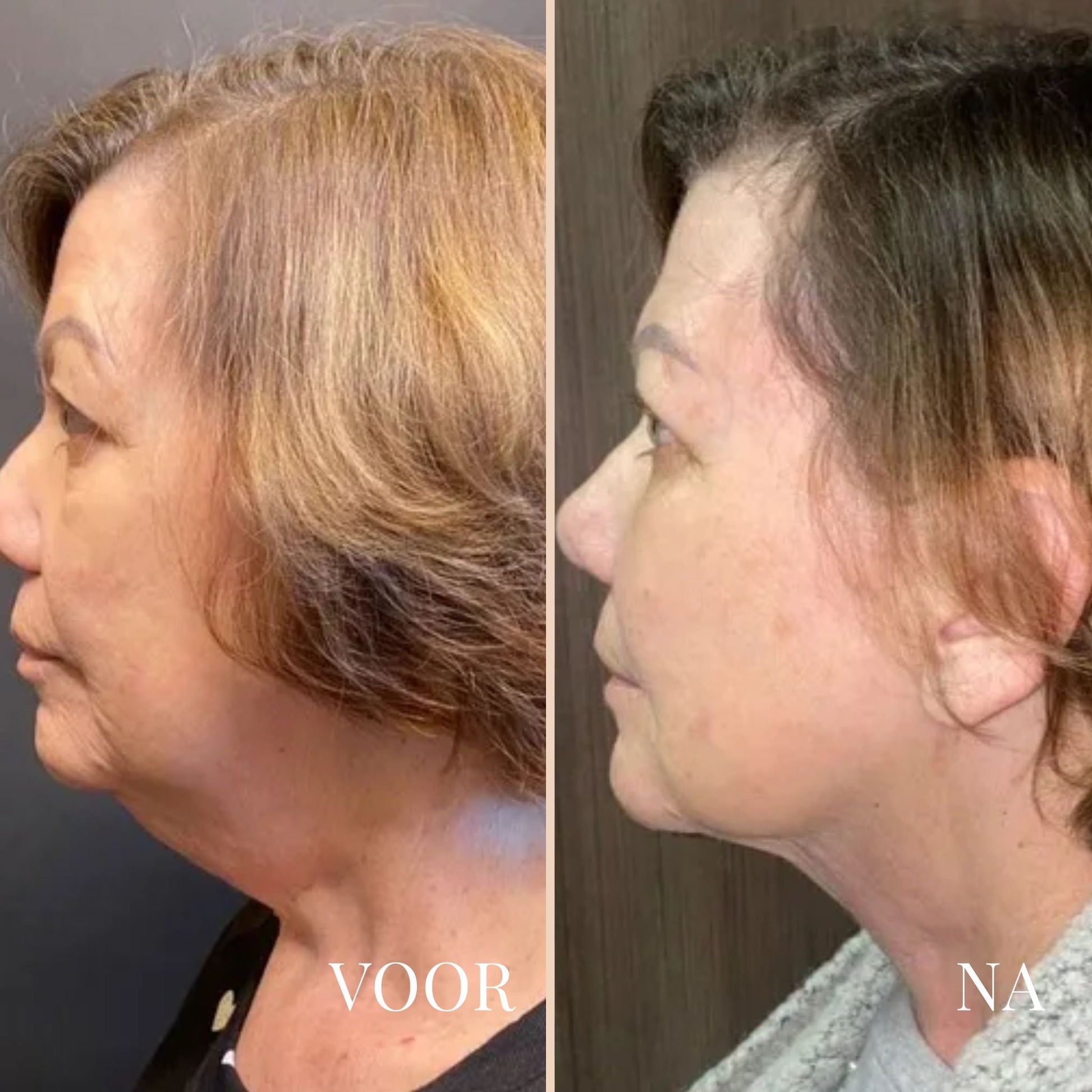 LinaLift | Huidverzorging Nek en Oog Versterker Crème 6