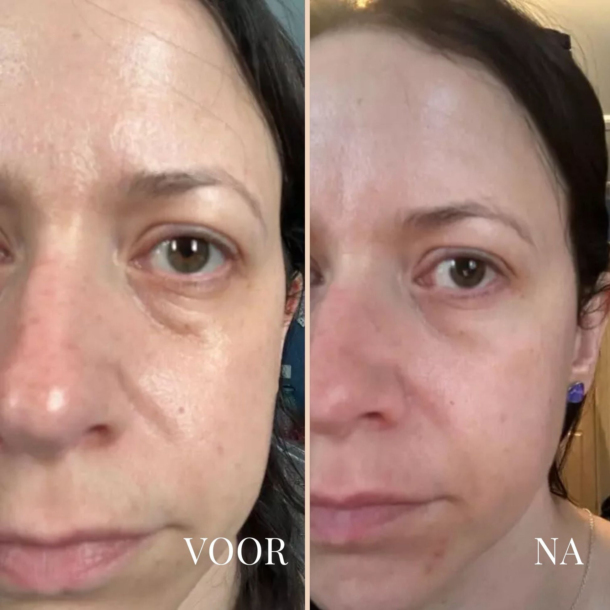 LinaLift | Huidverzorging Nek en Oog Versterker Crème 7