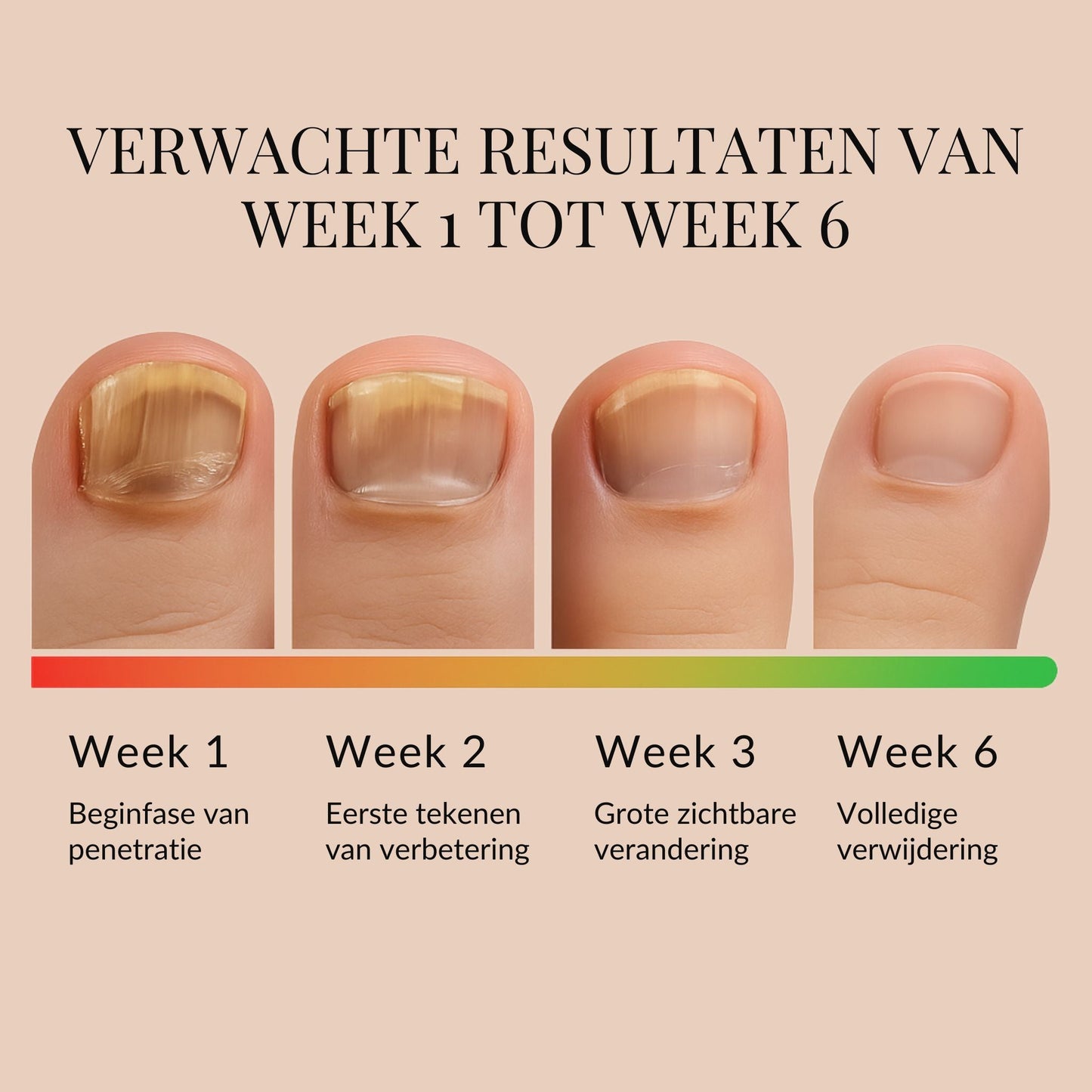 ReviveNail Herstelpleisters | Tegen Verkleurde Teennagels 1