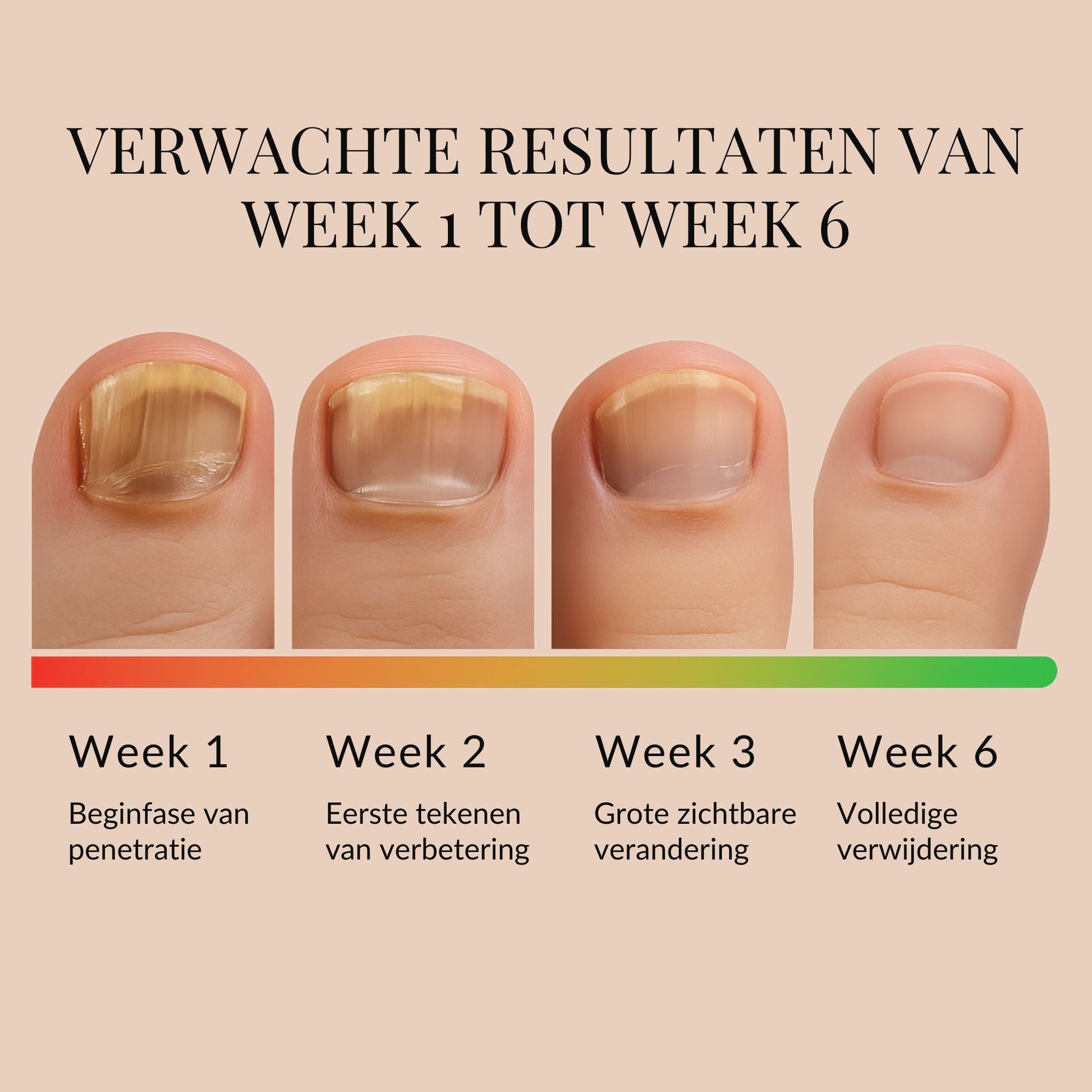 ReviveNail Herstelpleisters | Tegen Verkleurde Teennagels 1